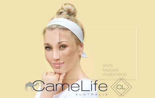 Sunspots and Camel Milk Skincare