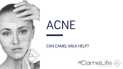 Camel Milk and Acne